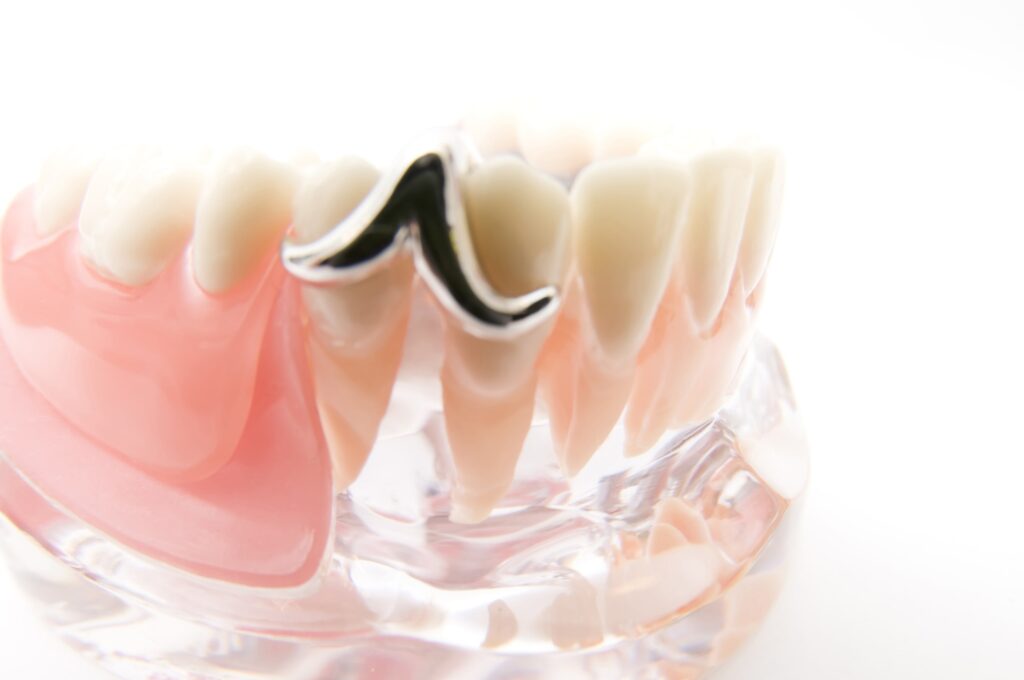当院の入れ歯治療の特徴