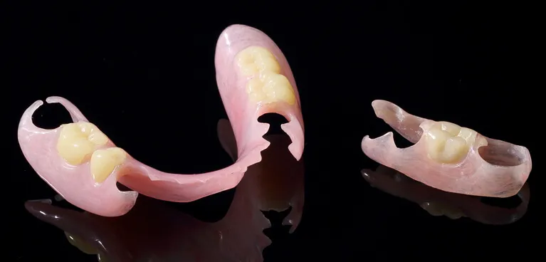 ノンクラスプデンチャー